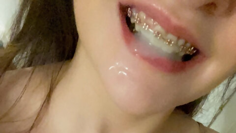 I loved his hot, thick cum covering my braces 😈